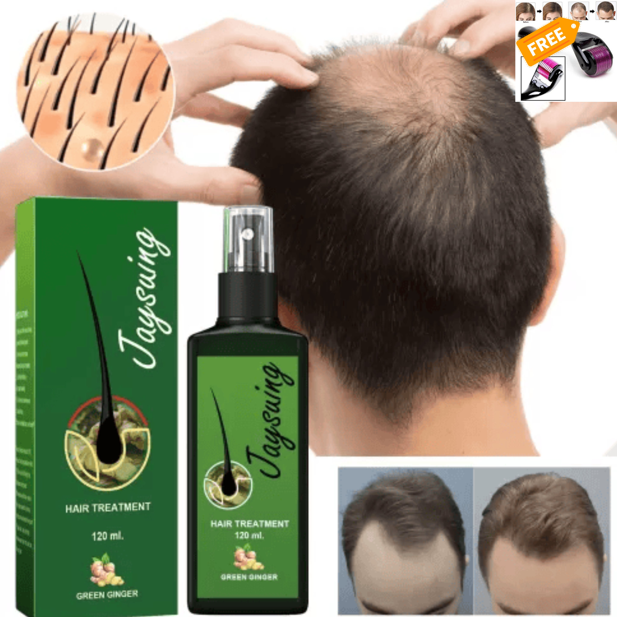 Jaysuing Hair Treatment + Derma Roller Gift